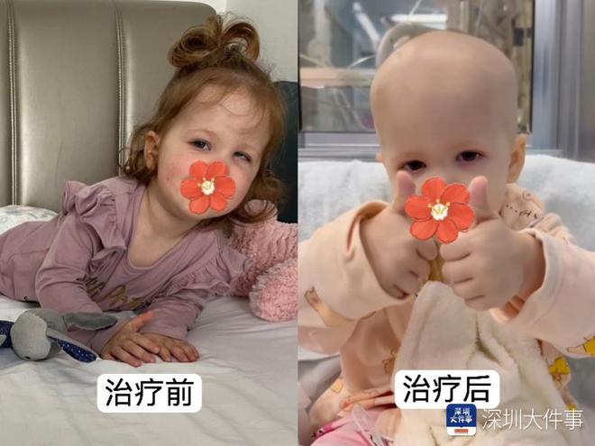 基因治療“逆天改命”！瑞典罕見(jiàn)遺傳病患兒萬(wàn)里赴粵重獲新生(圖2)